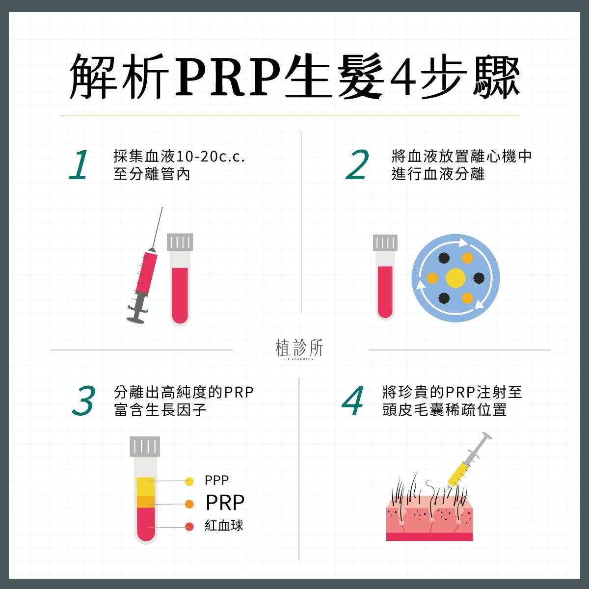 prp生髮步驟